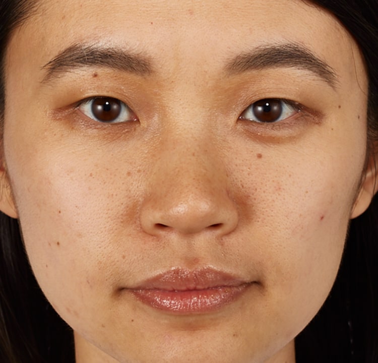 complexion before